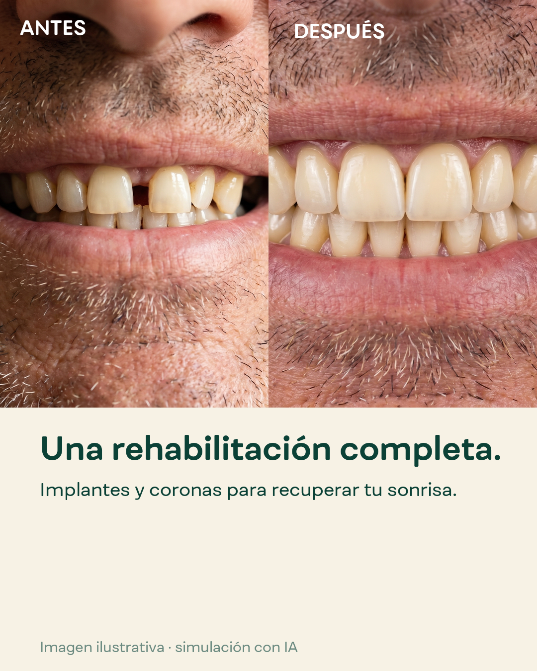 antes después