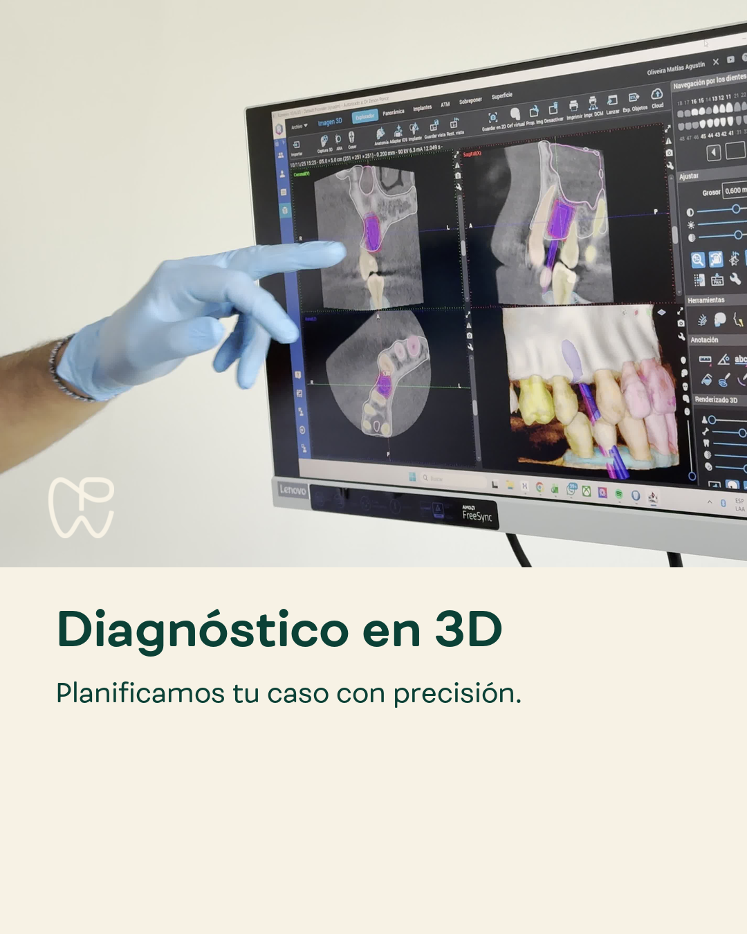 diagnóstico 3D